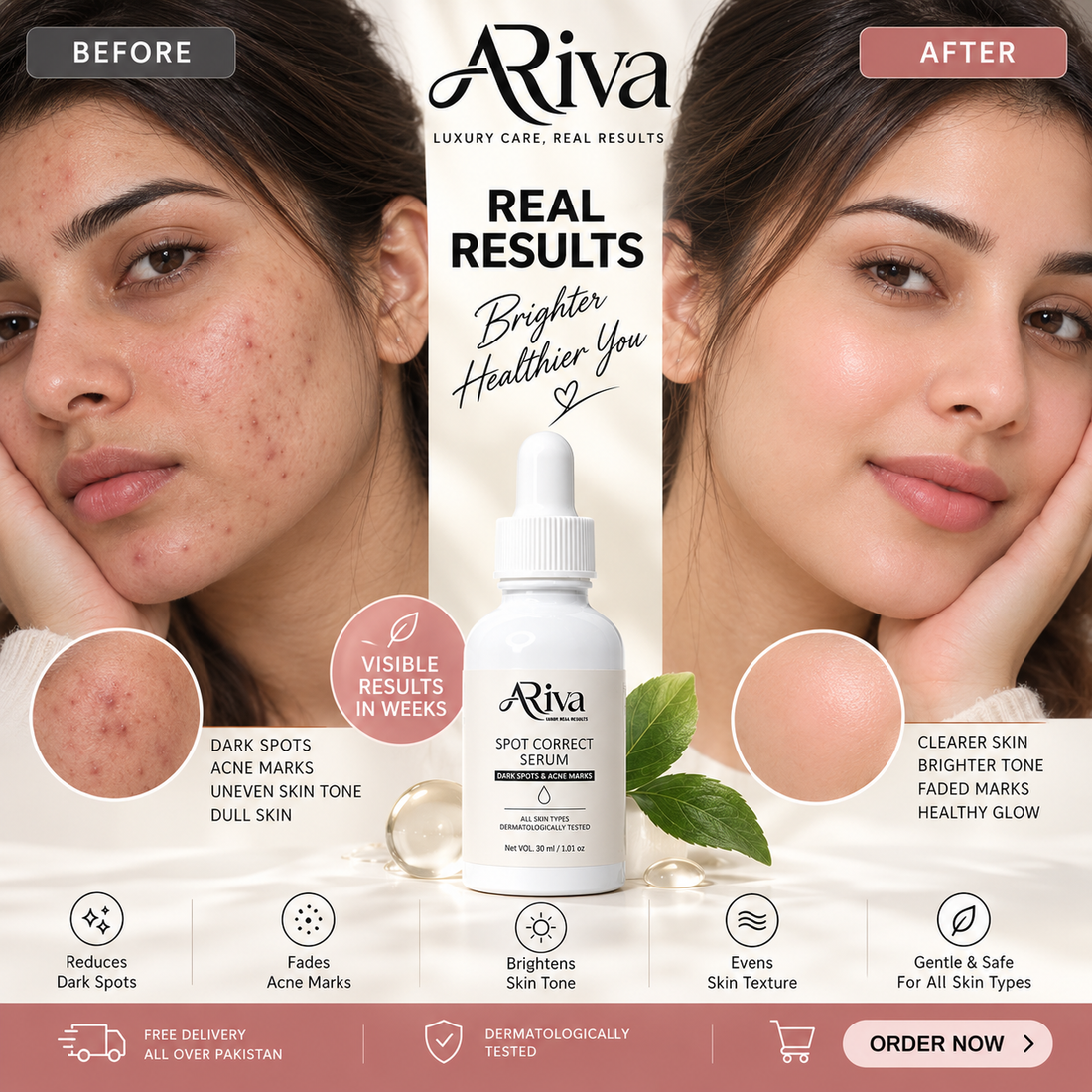 AURIVA Spot Correct Serum – Niacinamide for Dark Spots & Acne Marks